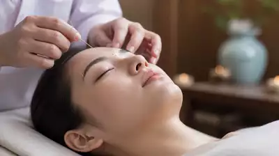 Augenakupunktur Therapie