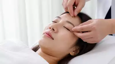 User receiving acupuncture treatment for eye health
